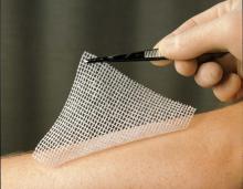 lomatuell Lomatuell H Gaasverband 10 cm x 10 cm 10st