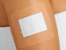 Curapor Wondpleister 10 x 15 cm Steriel 50st