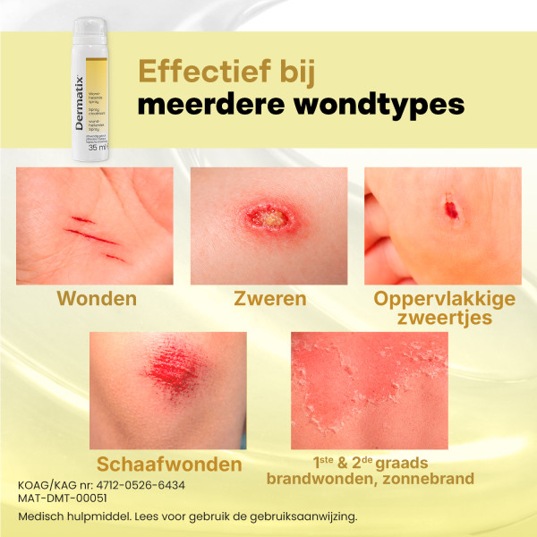 Dermatix Wondspray 35 ml