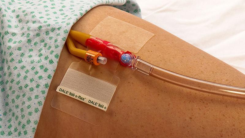 Katheter fixatiepleister 1 Stuk